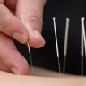 Acupuncture and Massage for immediate Pain relief